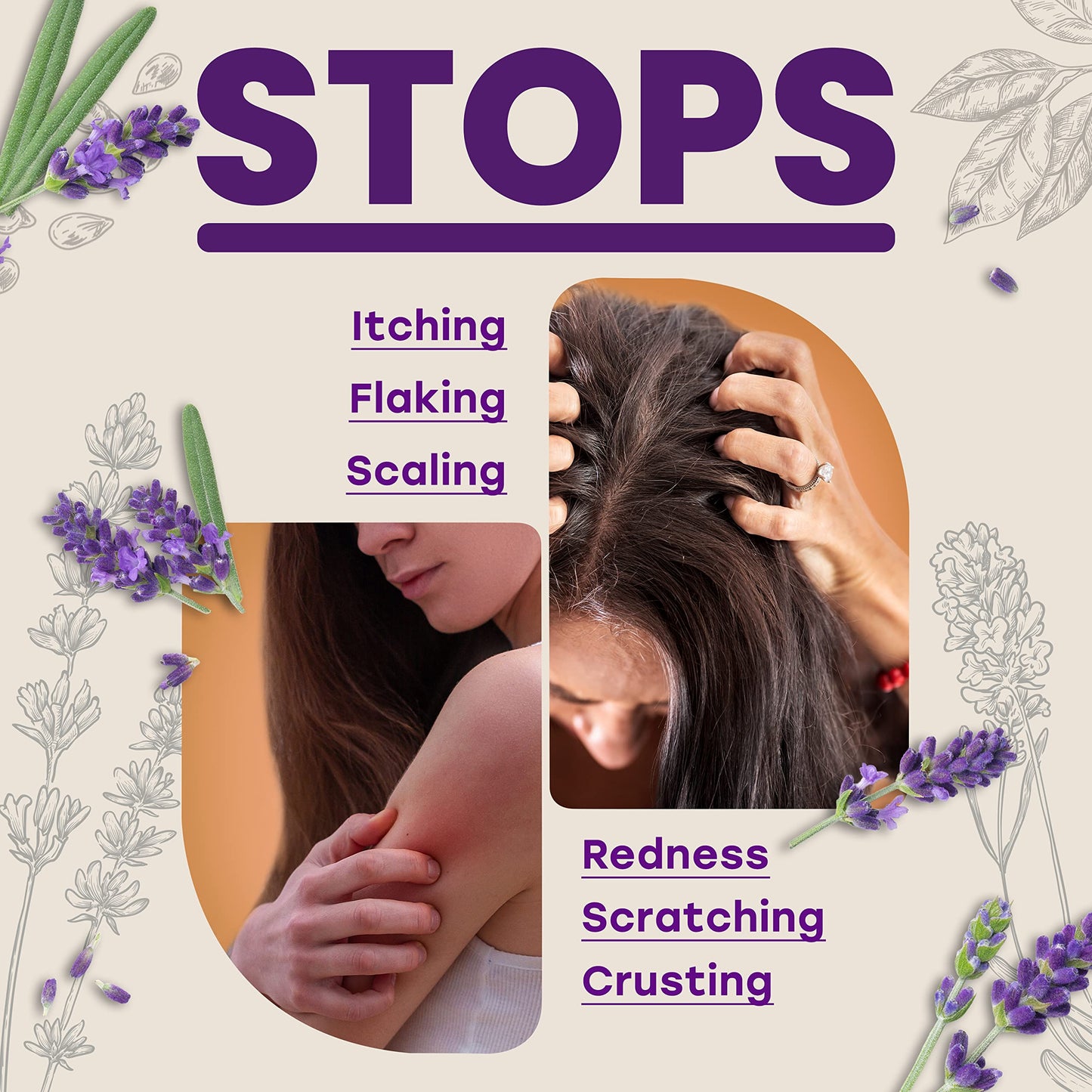 Candida Freedom Probiotic Soap - Lavender - Probiotic Skincare - Powerful Microbiome Support with the Candida Freedom® Bacillus, Antioxidant and Herbal Formula - Sensitive Skin Soap - Supports Acne-Prone Skin - Encourages Scalp Health