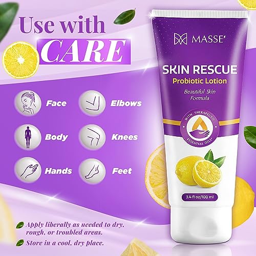 Masse' Skin Rescue Probiotic Lotion - Daily lotion for Men & Women - Refreshing Lemon Scent - Non-Greasy Moisture for Smooth & Sensitive Skin - 3.4 oz