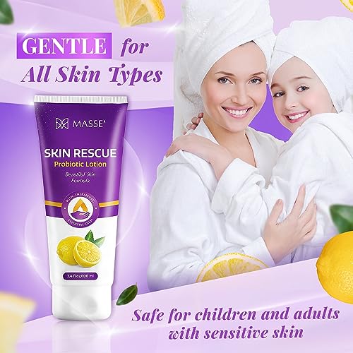 Masse' Skin Rescue Probiotic Lotion - Daily lotion for Men & Women - Refreshing Lemon Scent - Non-Greasy Moisture for Smooth & Sensitive Skin - 3.4 oz