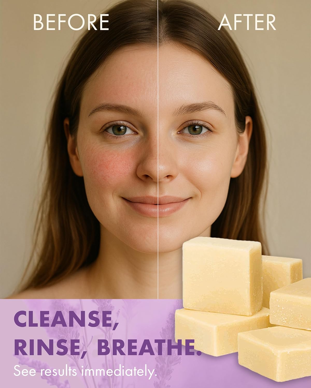 Candida Freedom Probiotic Soap - Lavender - Probiotic Skincare - Powerful Microbiome Support with the Candida Freedom® Bacillus, Antioxidant and Herbal Formula - Sensitive Skin Soap - Supports Acne-Prone Skin - Encourages Scalp Health