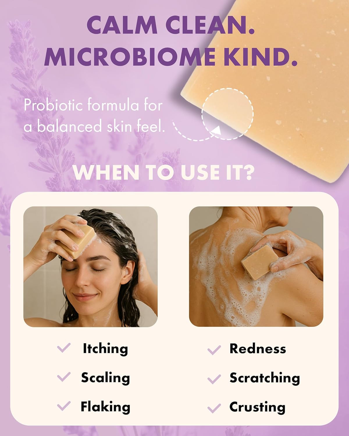 Candida Freedom Probiotic Soap - Lavender - Probiotic Skincare - Powerful Microbiome Support with the Candida Freedom® Bacillus, Antioxidant and Herbal Formula - Sensitive Skin Soap - Supports Acne-Prone Skin - Encourages Scalp Health