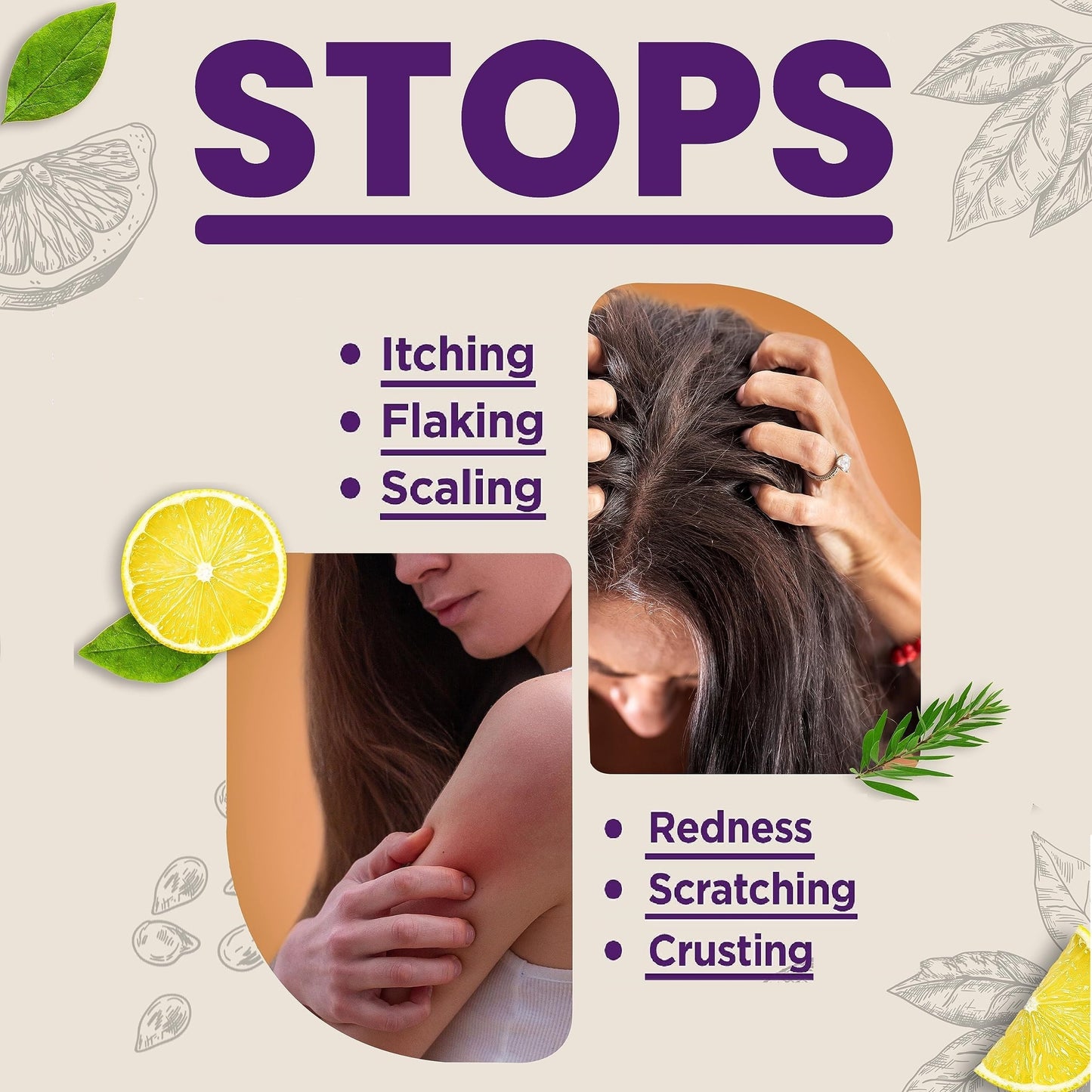 Candida Freedom Probiotic Soap - Original Lemon Formula - Probiotic Skincare - Powerful Microbiome Support with the Candida Freedom® Bacillus, Antioxidant and Herbal Formula - Sensitive Skin Soap - Supports Acne-Prone Skin - Encourages Scalp Health