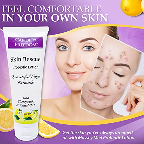 Masse' Skin Rescue Probiotic Lotion - Daily lotion for Men & Women - Refreshing Lemon Scent - Non-Greasy Moisture for Smooth & Sensitive Skin - 3.4 oz